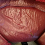 The same armchair before reupholstery, with worn and faded fabric